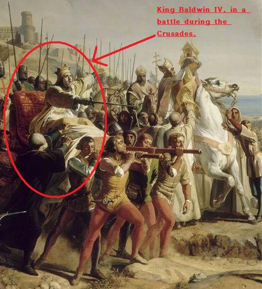 kingdom-of-heaven (character Baldwin IV) CLOSEUP painting depicting true essence of king in battle at Montgisard-Salles des Croisades2